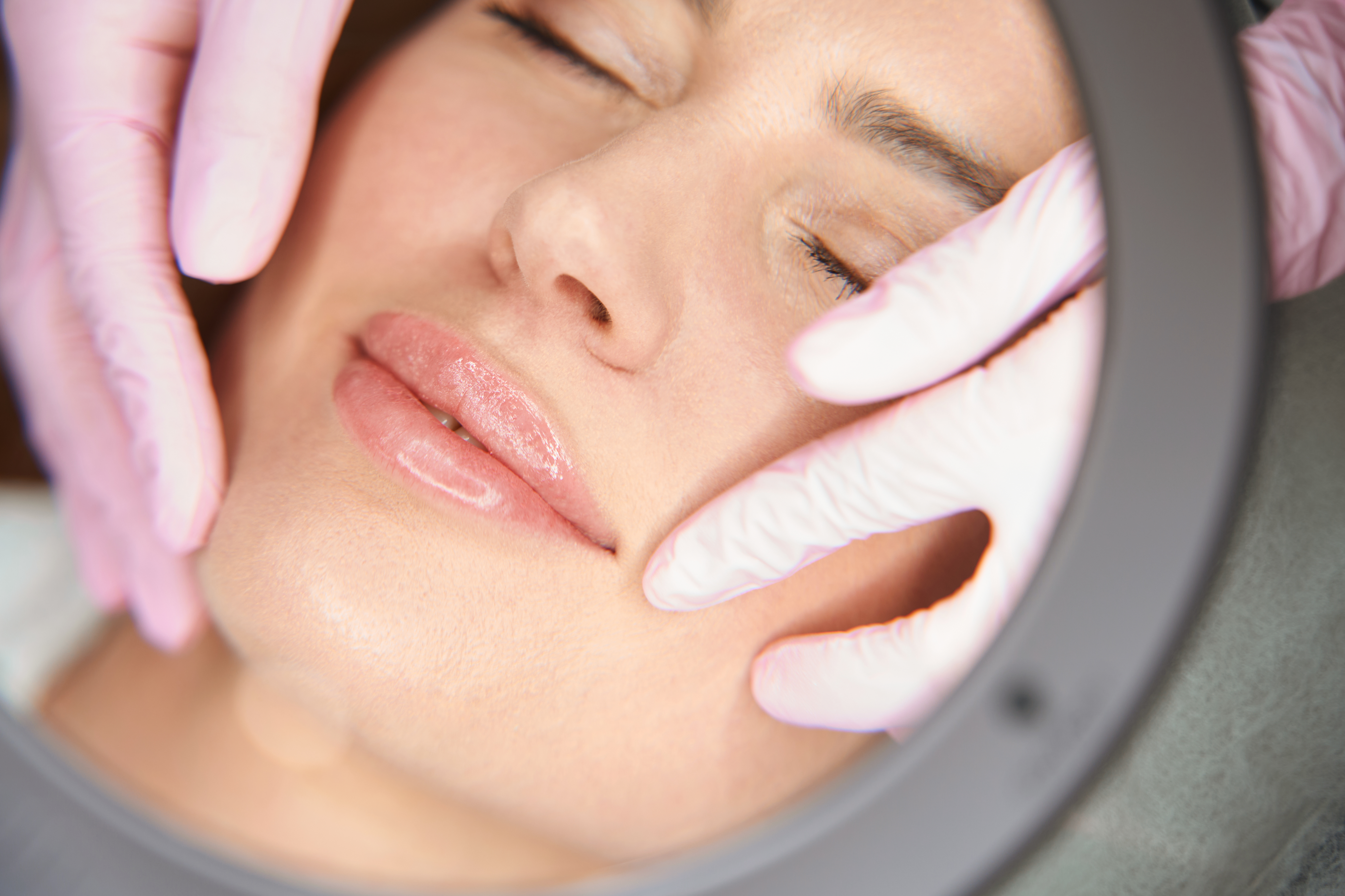 Lip Fillers At The Beauty Cellar NY