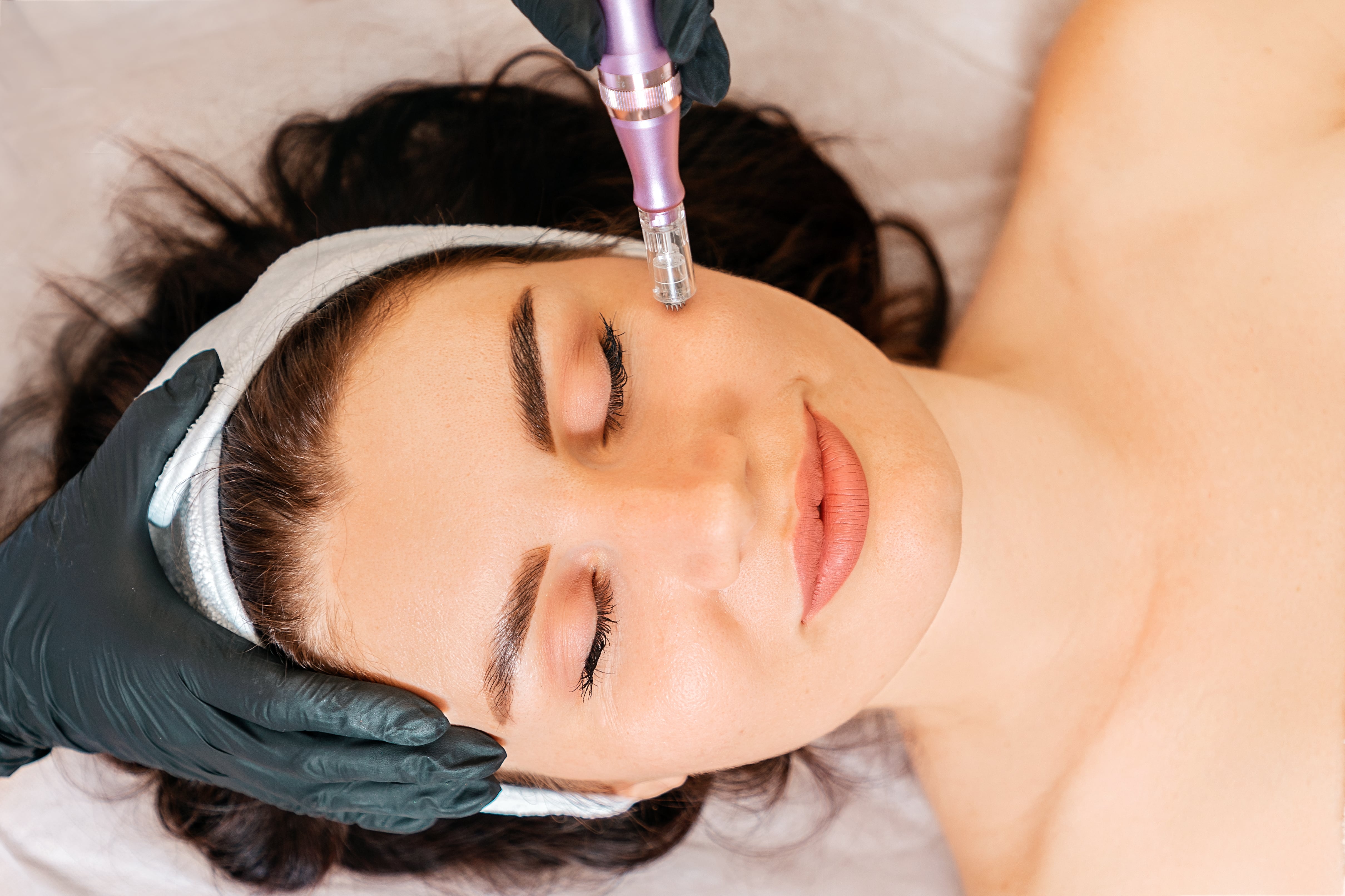 Microneedling At The Beauty Cellar NY